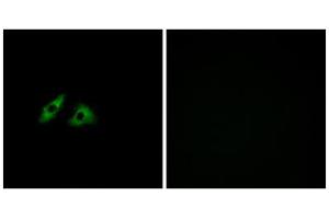 Immunofluorescence analysis of HeLa cells, using GPR152 antibody. (GPR152 Antikörper  (Internal Region))