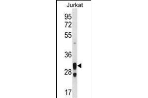 ACER1 Antibody (C-term) (ABIN1536908 and ABIN2850111) western blot analysis in Jurkat cell line lysates (35 μg/lane).