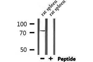 Western blot analysis of extracts from rat spleen, using GARS Antibody. (GARS Antikörper  (C-Term))