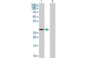 Western Blot analysis of RICTOR expression in transfected 293T cell line by RICTOR MaxPab polyclonal antibody. (RICTOR Antikörper  (AA 1-265))