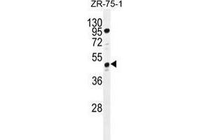 tcag7. (Tcag7.1071 (AA 417-438), (C-Term) Antikörper)