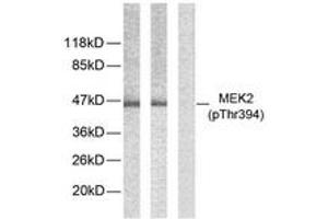 Western blot analysis of extracts from ovary cancer, using MEK2 (Phospho-Thr394) Antibody. (MEK2 Antikörper  (AA 261-310))