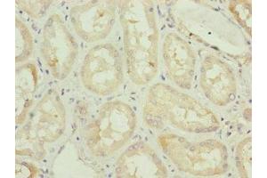 Immunohistochemistry (IHC) image for anti-TAM41, Mitochondrial Translocator Assembly and Maintenance Protein (TAMM41) (AA 161-452) antibody (ABIN7163117)