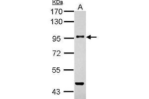 WB Image Sample (30 ug of whole cell lysate) A: THP-1 7. (TGFBR3 Antikörper  (N-Term))
