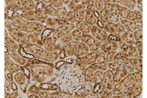 ABIN6275478 at 1/100 staining Rat kidney tissue by IHC-P.