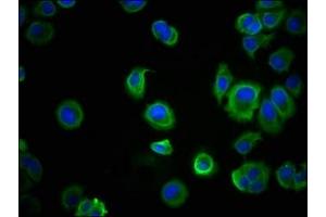 Immunofluorescence (IF) image for anti-Cadherin 1, Type 1, E-Cadherin (Epithelial) (CDH1) (AA 155-707) antibody (ABIN7146194)