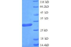 SDS-PAGE (SDS) image for Guanidinoacetate N-Methyltransferase (GAMT) (AA 1-236), (full length) protein (His tag) (ABIN5709557) (GAMT Protein (AA 1-236, full length) (His tag))