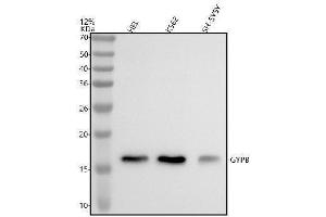 Western blot analysis of GYPB using anti-GYPB antibody (ABIN7825418).