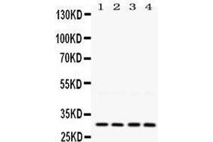 Western Blotting (WB) image for anti-Lysyl Oxidase (LOX) (AA 240-268), (Middle Region) antibody (ABIN3042506)