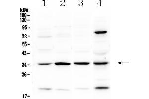 Western blot analysis of STUB1 using anti-STUB1 antibody . (STUB1 Antikörper  (AA 51-303))