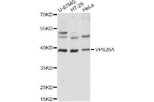 Western blot analysis of extracts of various cell lines, using VPS26A antibody (ABIN6292339) at 1:1000 dilution. (VPS26A Antikörper)