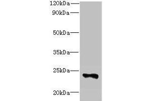 Western blot All lanes: FAM156A antibody at 5 μg/mL + Mouse heart tissue Secondary Goat polyclonal to rabbit IgG at 1/10000 dilution Predicted band size: 25 kDa Observed band size: 25 kDa (FAM156A Antikörper  (AA 1-153))