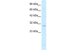 WB Suggested Anti-RALY Antibody Titration:  0. (Raly Antikörper  (N-Term))