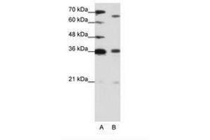 Image no. 1 for anti-PR Domain Containing 13 (PRDM13) (C-Term) antibody (ABIN202883) (PRDM13 Antikörper  (C-Term))