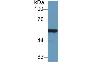 Western blot analysis of Rat Kidney lysate, using Mouse ALDH7A1 Antibody (1 µg/ml) and HRP-conjugated Goat Anti-Rabbit antibody ( (ALDH7A1 Antikörper  (AA 29-539))