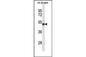 Western blot analysis of FOXG1 Antibody (Center) in mouse brain tissue lysates (35ug/lane). (FOXG1 Antikörper  (Middle Region))