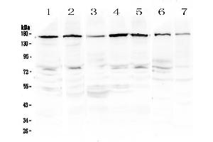 Western blot analysis of PER3 using anti-PER3 antibody . (PER3 Antikörper  (AA 1085-1199))