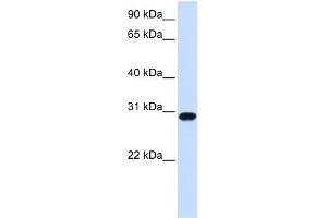 WB Suggested Anti-FOXR1 Antibody Titration:  0. (FOXR1 Antikörper  (N-Term))