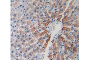 IHC-P analysis of liver tissue, with DAB staining.
