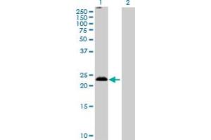 Western Blot analysis of MS4A5 expression in transfected 293T cell line by MS4A5 MaxPab polyclonal antibody. (MS4A5 Antikörper  (AA 1-200))