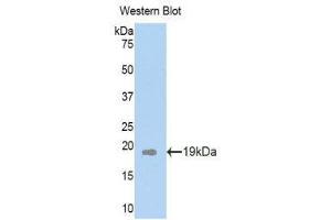 Western Blotting (WB) image for anti-Plexin B1 (PLXNB1) (AA 200-727) antibody (ABIN1860270) (PLXNB1 Antikörper  (AA 200-727))