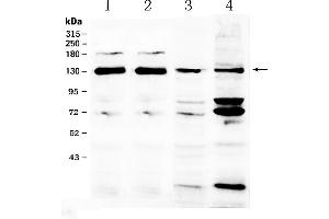 Western blot analysis of NCKAP1 using anti- NCKAP1 antibody . (NCKAP1 Antikörper  (AA 2-201))