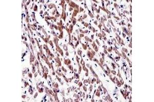 Immunohistochemistry analysis in human heart tissue (Formalin-fixed, Paraffin-embedded) using MOV10 Antibody (N-term), followed by peroxidase conjugated secondary antibody and DAB staining. (MOV10 Antikörper  (N-Term))
