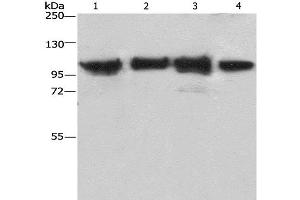 Western Blot analysis of Lovo cell and Mouse kidney tissue, 231 and hepG2 cell using ACTN4 Polyclonal Antibody at dilution of 1:485 (alpha Actinin 4 Antikörper)
