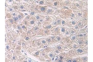 Immunohistochemistry (IHC) image for anti-Interleukin 7 Receptor (IL7R) (AA 173-260) antibody (ABIN7434320)