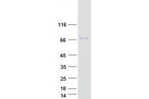 Western Blotting (WB) image for tRNA Methyltransferase 2 Homolog A (TRMT2A) (Transcript Variant 2) protein (Myc-DYKDDDDK Tag) (ABIN2712388)