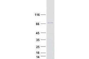 Validation with Western Blot (TRMT2A Protein (Transcript Variant 2) (Myc-DYKDDDDK Tag))