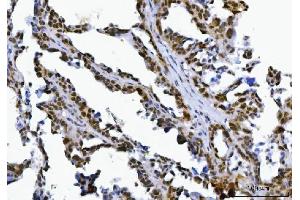 IHC analysis of SPT5/SUPT5H using anti-SPT5/SUPT5H antibody (ABIN7601985). (SUPT5H Antikörper  (AA 533-1087))