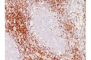 Formalin-fixed, paraffin-embedded Tonsil stained with CD6 Monoclonal Antibody (SPM547) (CD6 Antikörper)