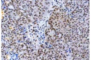 IHC analysis of HnRNP H/HNRNPH1 using anti-HnRNP H/HNRNPH1 antibody (ABIN4886623).