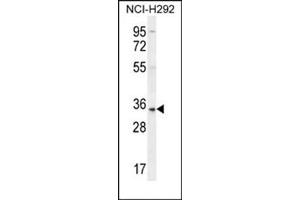 Western blot analysis using SFTPA2B Antibody (C-term) Cat. (SFTPA2 Antikörper  (C-Term))