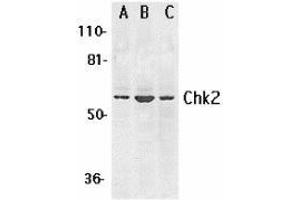 Western blot analysis of Chk2 expression in K562 (A), Jurkat (B), and HL-60 (C) whole cell lysates with AP30226PU-N Chk2 antibody at 1 μg /ml.