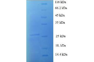 SDS-PAGE (SDS) image for S100 Calcium Binding Protein A1 (S100A1) (AA 2-94) protein (His-SUMO Tag) (ABIN4976038) (S100A1 Protein (AA 2-94) (His-SUMO Tag))