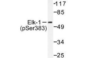 Image no. 1 for anti-ELK1, Member of ETS Oncogene Family (ELK1) (pSer383) antibody (ABIN318012) (ELK1 Antikörper  (pSer383))