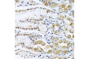 Immunohistochemistry of paraffin-embedded human stomach using TRMT1 antibody (ABIN5975089) at dilution of 1/100 (40x lens). (TRMT1 Antikörper)