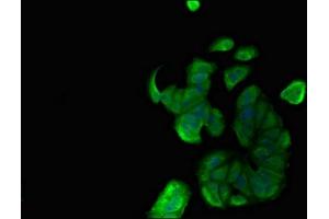 Immunofluorescent analysis of MCF-7 cells using ABIN7160462 at dilution of 1:100 and Alexa Fluor 488-congugated AffiniPure Goat Anti-Rabbit IgG(H+L) (MNDA Antikörper  (AA 84-233))