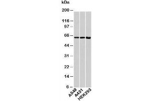 Western blot testing of human samples with HSP60 antibody at 1ug/ml. (HSPD1 Antikörper)
