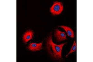 Immunofluorescent analysis of Collagen 11 alpha 1 staining in K562 cells.