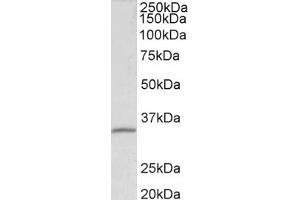 Western Blotting (WB) image for anti-Fibrillarin (FBL) (AA 99-110) antibody (ABIN5901192) (Fibrillarin Antikörper  (AA 99-110))