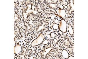 IHC analysis of SPHK1 using anti-SPHK1 antibody (ABIN7600168). (SPHK1 Antikörper  (AA 16-267))