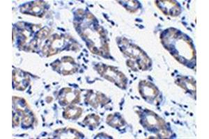 Image no. 2 for anti-Phorbol-12-Myristate-13-Acetate-Induced Protein 1 (PMAIP1) (N-Term) antibody (ABIN318707) (NOXA Antikörper  (N-Term))