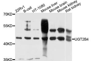 Western blot analysis of extracts of various cell lines, using μgT2B4 antibody (ABIN5972312) at 1/1000 dilution. (UGT2B4 Antikörper)
