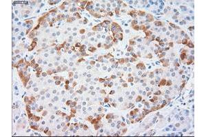 Immunohistochemistry (IHC) image for anti-Keratin 18 (KRT18) (AA 69-372) antibody (ABIN1491638) (Cytokeratin 18 Antikörper  (AA 69-372))