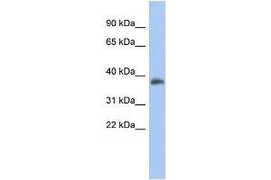 WB Suggested Anti-FOXB1 Antibody Titration:  0. (FOXB1 Antikörper  (Middle Region))