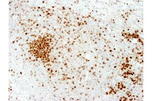 Immunohistochemistry (IHC) image for anti-Antigen Identified By Monoclonal Antibody Ki-67 (MKI67) (AA 1650-1700) antibody (ABIN7448620) (Ki-67 Antikörper  (AA 1650-1700))