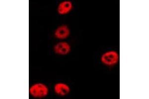 ABIN6275223 staining LOVO by IF/ICC. (REC8 Antikörper  (Internal Region))